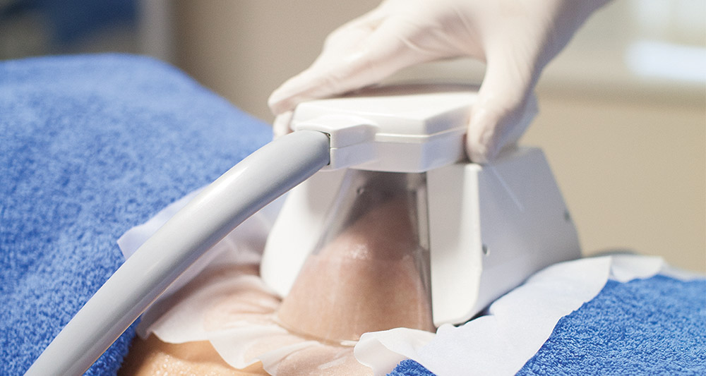 How Fat Freezing and HIFU Work Together? 2 Multiple Areas in One Session HIFU and Fat Freezing Llanelli