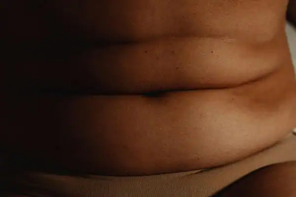 The Hidden Connection: How Stress Shapes Your Fitness and Body Composition 3 image of what stress can do on the stomach area and how Lipo 360 Llanelli can help to change your body shape.